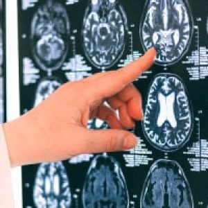 Diploma in Neuro-linguistic Perspectives